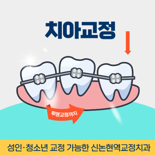 강릉치과 강릉시 치과 치아교정