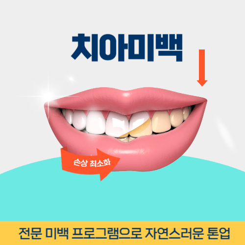 강릉치과 강릉시 치과 치아미백