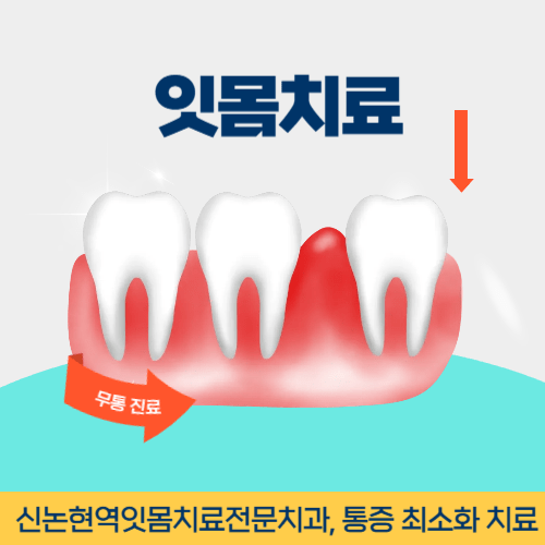 강릉치과 강릉시 치과 잇몸치료